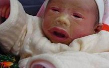 多囊患者想做试管这些步骤一定要了解